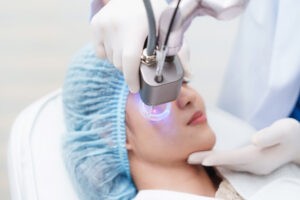 Patient receiving CO2 laser skin resurfacing treatment on the face, performed by a specialist at a clinic